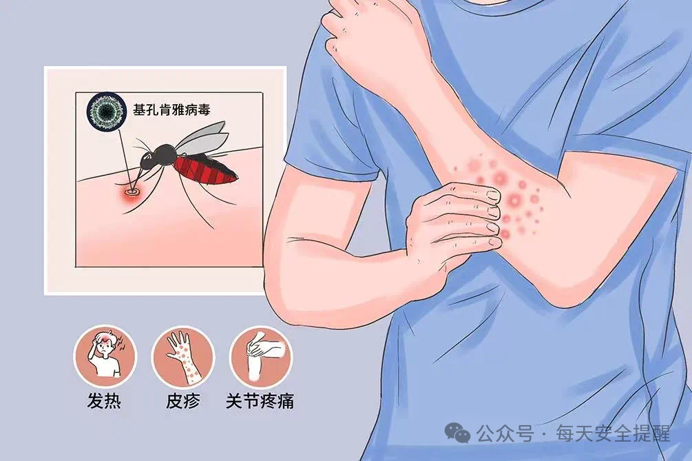 感染一次基孔肯雅热可终身免疫？回应来了