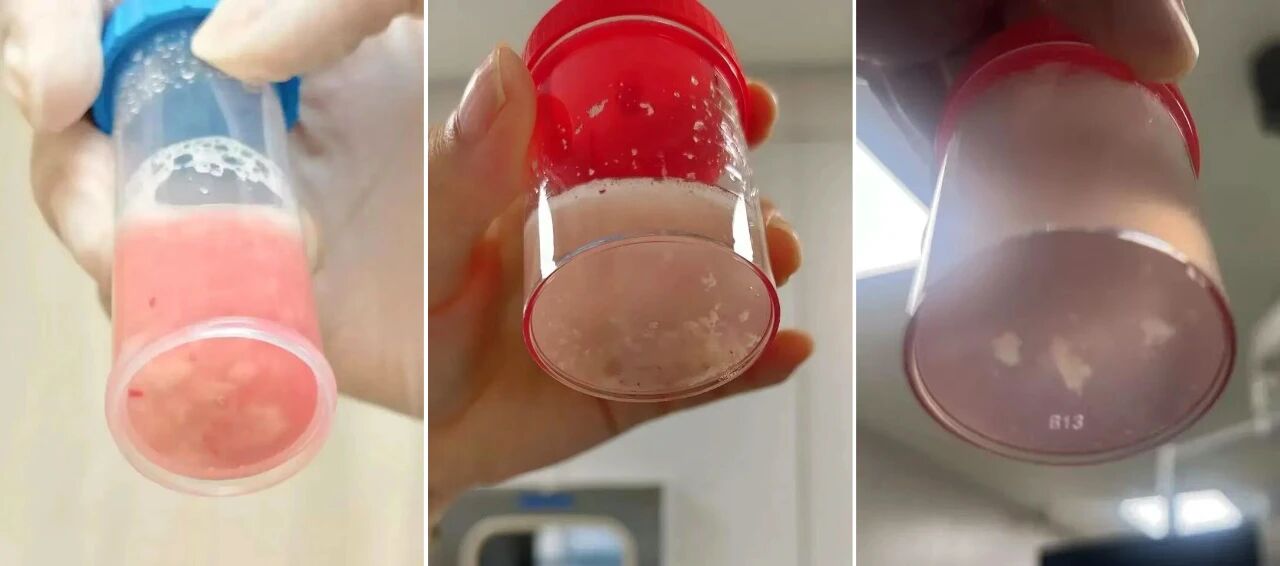 a2817198eb3ce82bf6d8c1e6ec91dae9.jpg a2817198eb3ce82bf6d8c1e6ec91dae9.jpg