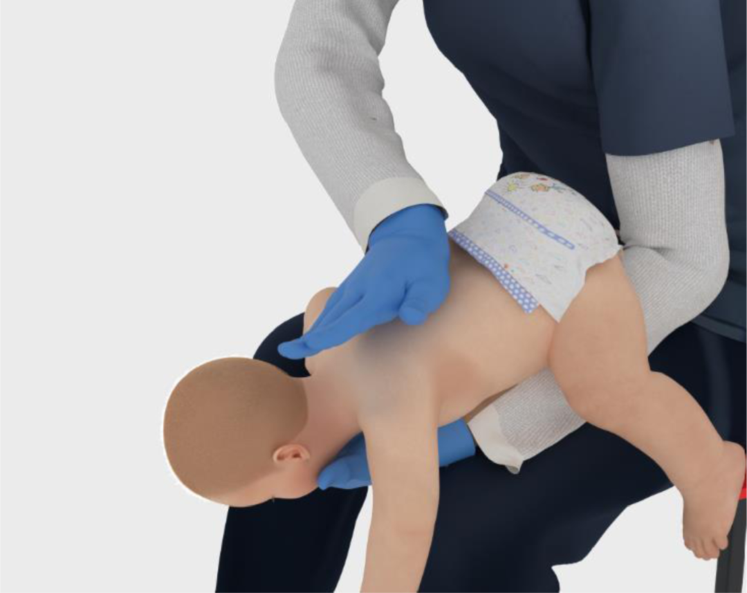 救命技能升级！2025海姆立克指南更新