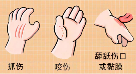 被动物咬伤、抓伤，如何处理才不会感染？