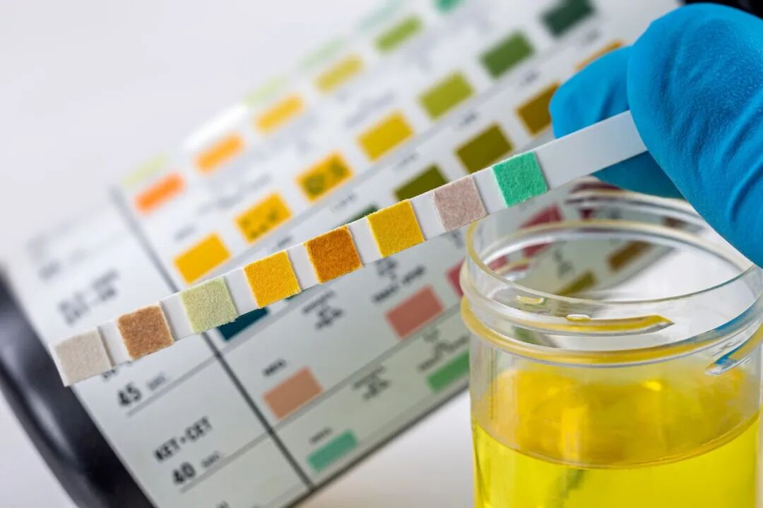 小便出现这 3 种变化，可能是肾脏在“求救”！千万别忽视